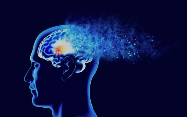 Alzheimer