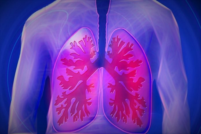 Lung 696x463